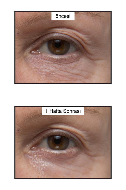 Murad Age Reform Rapid Collagen Infusion Collagen Serum - Anti-aging Hydrating Serum for All Skin Types