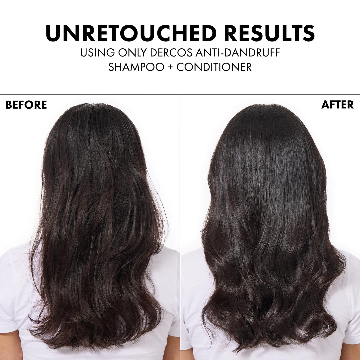 Vichy Dercos Anti-Dandruff Shampoo for Dry Hair - 500ml Refill, Dermatologically Tested, Paraben-Free