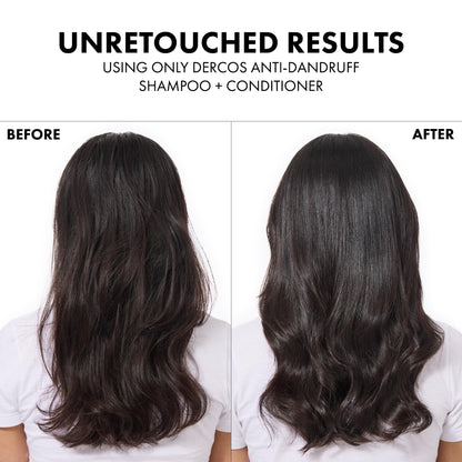 Vichy Dercos Densi-Solutions Thickening Shampoo for Thinning Hair - Strengthens, Thickens, and Stimulates Scalp - 13.53 fl oz