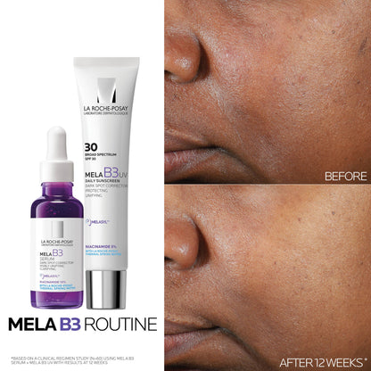 La Roche Posay MELA B3 Dark Spot Anti Serum 30 ml