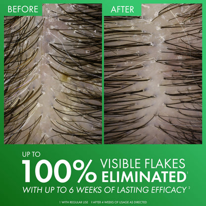 Vichy Dercos Anti-Hair Loss Shampoo with Aminexil - Strengthening, 6.76 fl oz