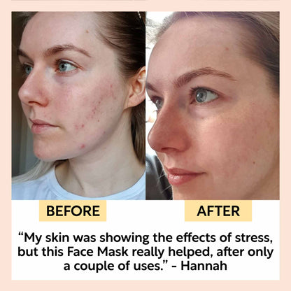 Kaolin Clay Face Mask